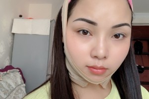 上海首爾麗格整形醫(yī)院下頜角/價格表+圖片對比