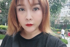 上海首爾麗格整形醫(yī)院價(jià)格表顴骨手術(shù)全過(guò)程分享