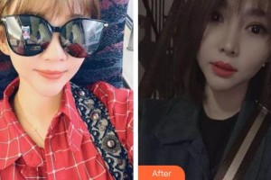 東莞韓美整形醫(yī)院黃玉潔主診醫(yī)師整形價(jià)格表附鼻部綜合案例展示