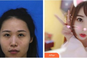 東莞百佳瑪麗亞婦產(chǎn)醫(yī)院蔡強(qiáng)整形價(jià)格表附鼻部綜合案例展示