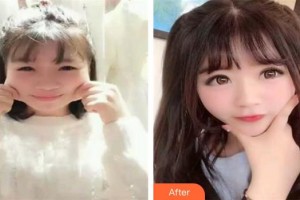 東莞愛爾眼科醫(yī)院劉斐整形價(jià)格表附埋線雙眼皮案例展示