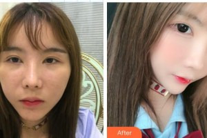 東莞南城固德口腔門診部孟建整形價(jià)格表附美白貼片案例展示