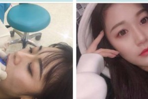 東莞南城固德口腔門診部梁波整形價格表附牙齒隱形矯正案例展示