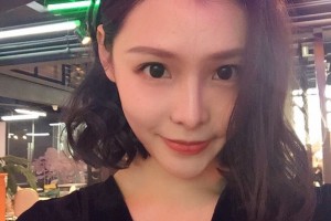 上海華美醫(yī)院下頜角手術(shù)怎么樣附手術(shù)過(guò)程分享