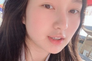 濟(jì)寧附屬醫(yī)院整形科下顎角感覺(jué)怎樣？真人案例圖片對(duì)比