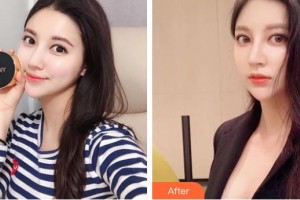 東陽麗萊醫(yī)療美容醫(yī)院蔡振勇整形價格表附鼻部綜合案例展示