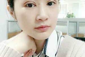 邯鄲三院做雙眼皮怎么樣附果圖|價格表