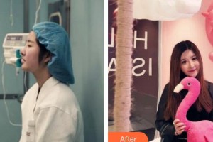 李康元整形價格表附鼻部綜合案例展示