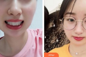 東海濟民醫(yī)療美容門診部王淙欽整形價格表附牙齒隱形矯正案例展示