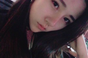 山東濟(jì)南章丘中醫(yī)院雙眼皮手術(shù)案例果圖