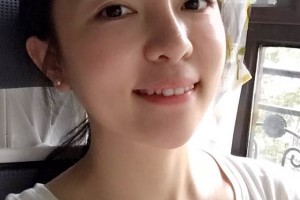 深圳臻瑞芝美醫(yī)院正規(guī)嗎牙齒矯正后變化太大了|價格表