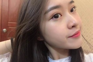 南京柏盛醫(yī)院雙眼皮手術(shù)果對比圖展示 附價格表一覽