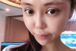 廈門第一醫(yī)院怎么樣附果圖