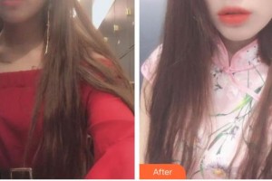 安岳潤(rùn)白顏醫(yī)療整形美容門(mén)診部蔣永強(qiáng) 整形價(jià)格表附紅藍(lán)光祛痘案例展示