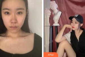 安岳潤(rùn)白顏醫(yī)療整形美容門(mén)診部辛智希整形價(jià)格表附激光去紅血絲案例展示