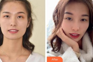 溧陽(yáng)幫明口腔門(mén)診部金幫明整形價(jià)格表附牙齒隱形矯正案例展示