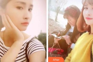 海寧市人民醫(yī)院醫(yī)療美容科張建強(qiáng)整形價(jià)格表附美白劑美白牙齒案例展示