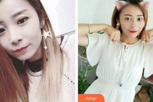 西藏阜康醫(yī)院口腔科趙霞整形價(jià)格表附牙齒隱形矯正案例展示