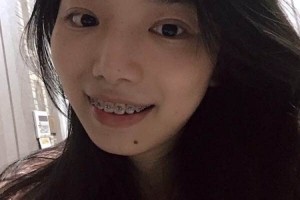 長(zhǎng)春雅貝嘉口腔費(fèi)用高不高附價(jià)格表