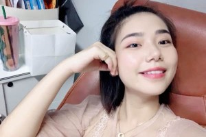 山東威海宇建口腔怎么樣牙齒矯正后果太好了