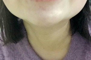 哈爾濱圣安口腔醫(yī)院怎么樣？附牙齒矯正果圖