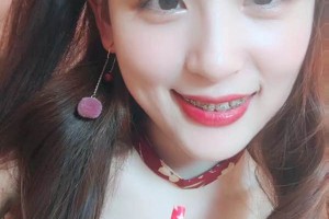 合肥艾雅醫(yī)療美容醫(yī)院怎么樣？附切開雙眼皮對(duì)比圖