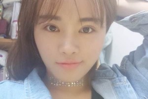 杭州117醫(yī)院整形科主任雙眼皮怎么樣？附果圖展示