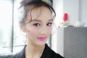 鄭州美立方整形醫(yī)院雙眼皮果好不好？怎么樣？附案例對(duì)比圖