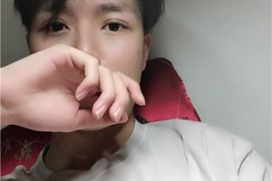 汕頭附一醫(yī)院整形好不好割雙眼皮全過程|醫(yī)生推薦