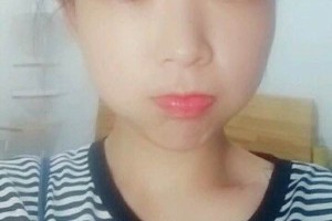 鄭州二附院美容怎么樣雙眼皮果分享|醫(yī)生推薦