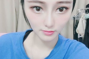 上海華山醫(yī)院環(huán)境怎么樣隆鼻全過(guò)程分享