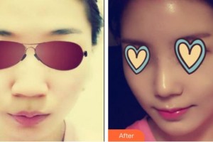 吳甲聲教授整形價(jià)格表附鼻部綜合案例展示