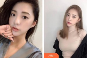 成武縣人民醫(yī)院醫(yī)學(xué)美容科張凌云整形價(jià)格表附鼻部綜合案例展示