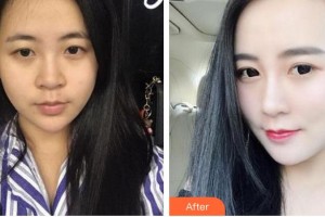 朱云整形價(jià)格表附鼻部綜合案例展示