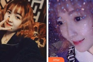 龐清澤整形價(jià)格表附超聲波潔牙案例展示