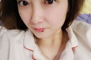 上海復(fù)美醫(yī)療美容門(mén)診部割雙眼皮日記|價(jià)格表