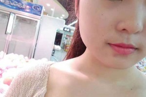 上海美蘭德整形醫(yī)院割雙眼皮果太好了單眼皮逆襲