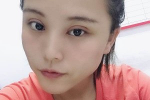 哈爾濱醫(yī)大二院割雙眼皮果太棒了|2021價(jià)格表