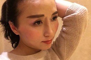 無錫人民醫(yī)院植發(fā)怎么樣附果圖