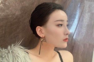 廣州中山大學(xué)附屬醫(yī)院植發(fā)怎么樣附果圖