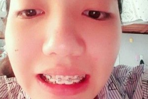 合肥新安口腔醫(yī)院靠譜么口碑好不好安附果圖