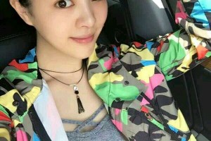 上海星璨整形醫(yī)院好不好隆鼻價格多少|價格表