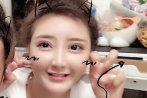 新橋醫(yī)院割雙眼皮恢復果怎么樣|醫(yī)生推薦|價格表