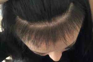 平頂山醫(yī)美整形植發(fā)手術(shù)怎么樣附價(jià)格表