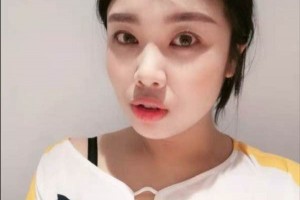 遼寧丹東金澄美容醫(yī)院光子嫩膚果，多久做一次附價格表