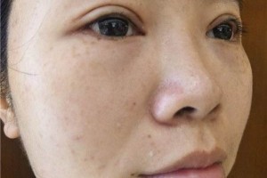 青醫(yī)附院整形美容科怎么樣附果圖