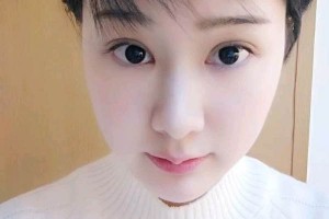 南京省中醫(yī)院做雙眼皮怎么樣附果圖