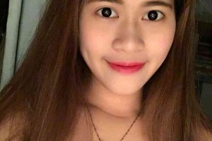 湖南株洲中心醫(yī)院整形科？雙眼皮術(shù)后注意事項(xiàng)！