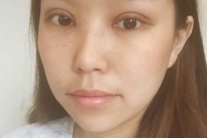 寧波第一院整容科項目好不好？科室醫(yī)生介紹！