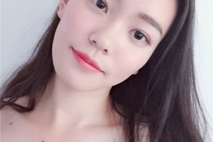 無錫中醫(yī)院整形科如何？雙眼皮成功案例測(cè)評(píng)分享！